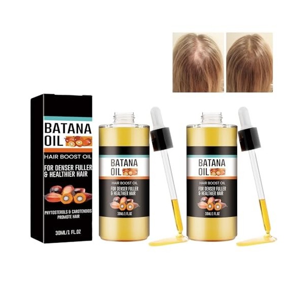 Grgowe 2Pc Huile De Batana Bio Pour La Croissance Des Cheveux,Huile De Batana Pour Cheveux,Huile De Batana Organic For Growth