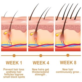 Soins des Cheveux et Huile, 2Pcs Huile Capillaire à lExtrait de Riz, Huile Capillaire pour une Pousse des Cheveux Très Rapid