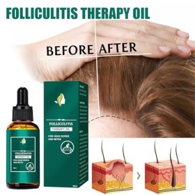 2Pcs Huile Capillaire au Gingembre, Soins des Cheveux et Huile, Huile Capillaire pour une Pousse des Cheveux Très Rapide, Nou