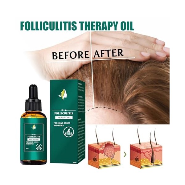 2Pcs Huile Capillaire au Gingembre, Soins des Cheveux et Huile, Huile Capillaire pour une Pousse des Cheveux Très Rapide, Nou