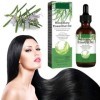Huile De Romarin Pour Cheveux, Hair Growth Oil, Huile Essentielle Romarin, Rosemary Oil For Hair Growth, Huile Essentielle De
