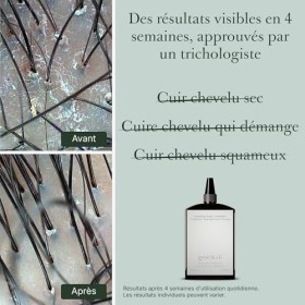 Good&All Traitement Anti-Démangeaisons Pour Cuir Chevelu Irrité, Sec & Sensibles - Sans Rinçage, Parfum - avec Menthe Poivrée