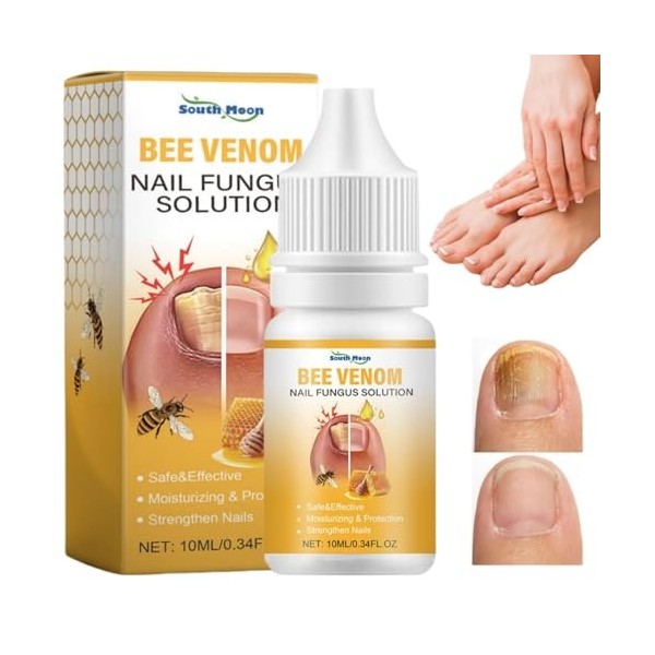 Solution apaisante pour ongles au venin dabeille, sérum de traitement des ongles au venin dabeille, sérum de croissance et 
