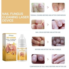 Solution apaisante pour ongles au venin dabeille, sérum de traitement des ongles au venin dabeille, sérum de croissance et 