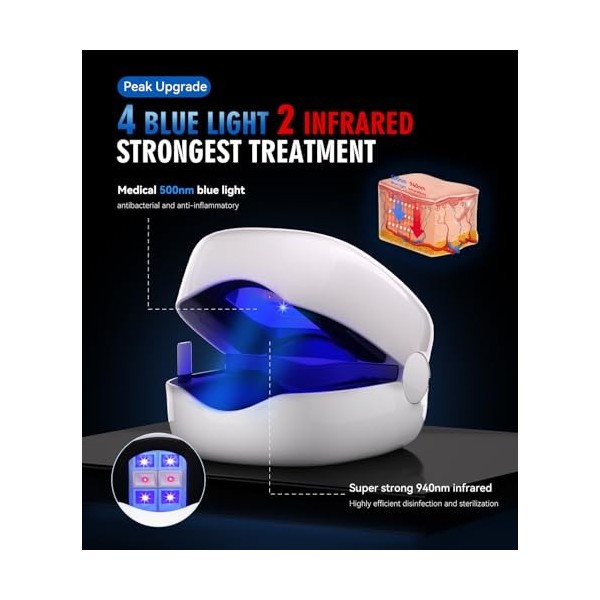 IUHFSIFS Laser antifongique amélioré 【Mise à niveau 2 x lumière infrarouge – Double traitement】【Lumière rouge plus forte 940