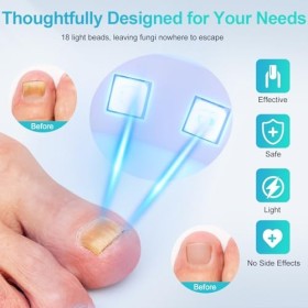 Dispositif de Laser pour Mycose Des Ongles, VETTOP Dispositif des Champignons des Ongles, 3 Temps Réglable et Appareil Réglab