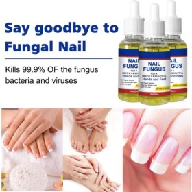 Traitement fongique des ongles, traitement des ongles dorteils, kit de réparation extra fort, soin des ongles, répare les on