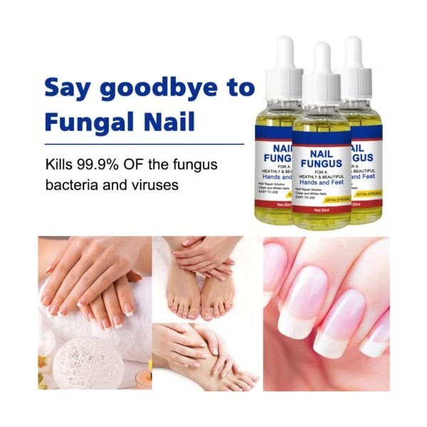 Traitement fongique des ongles, traitement des ongles dorteils, kit de réparation extra fort, soin des ongles, répare les on