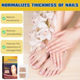 96 Pièces Pansements pour Ongles Mycoses Patch Correcteur Dongles Dorteils Patchs de Réparation de Longle pour Ongles Abîm