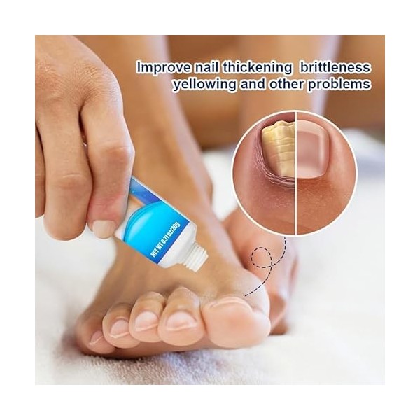 Nail repair Cream, soin des ongles mains et pieds en bonne santé, soin des ongles pied Nail repair Cream restaure lapparence