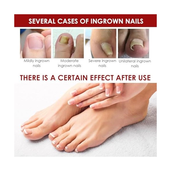 8ml Ongles Réparateurs,Nourrissantes et Réparatrices pour ongles