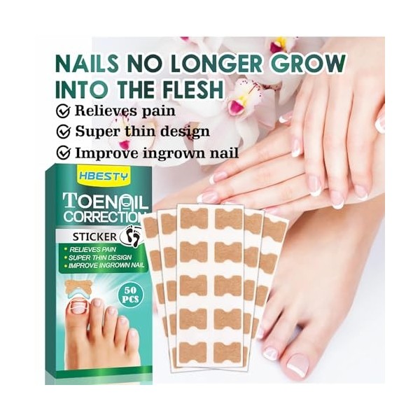 mercham Lot de 100 patchs de réparation des ongles, traitement fongique et ongles incarnés, autocollant de correction des ong
