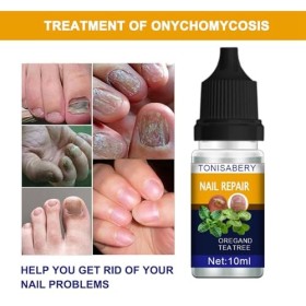 Solution de soins des ongles, gouttes végétales pour le soin des ongles, sérum apaisant pour les pieds, soin des orteils épai