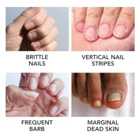 Huile pour cuticules répare les coins des ongles – Revitalise lhuile pour cuticules – Protection des doigts – Huile pour cut