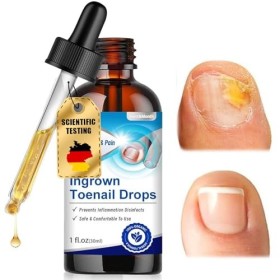 30 ml Traitement pour Les Pieds, mélange pour le soin des ongles, Renforce et Protege Les Ongles, nourrissant et réparatrices
