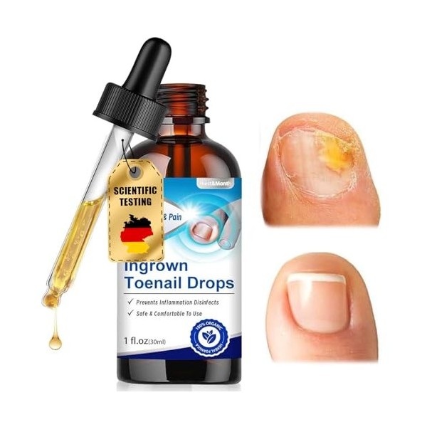 30 ml Traitement pour Les Pieds, mélange pour le soin des ongles, Renforce et Protege Les Ongles, nourrissant et réparatrices