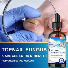 30 ml Traitement pour Les Pieds, mélange pour le soin des ongles, Renforce et Protege Les Ongles, nourrissant et réparatrices