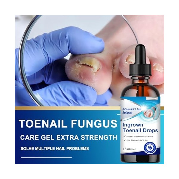 30 ml Traitement pour Les Pieds, mélange pour le soin des ongles, Renforce et Protege Les Ongles, nourrissant et réparatrices