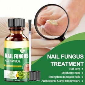 30ml Soins Pour Les Ongles, Soin Ongles Pied et Main, Nourrissant et Apaisant pour Ongles, Application Facile Au Pinceau