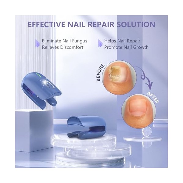 iKeener Appareil Traitement Laser Mycose Ongle Pied, FDA Approuvé Pied Traitement Soin Ongles pour Ortho Vital Mycose, 470nm 