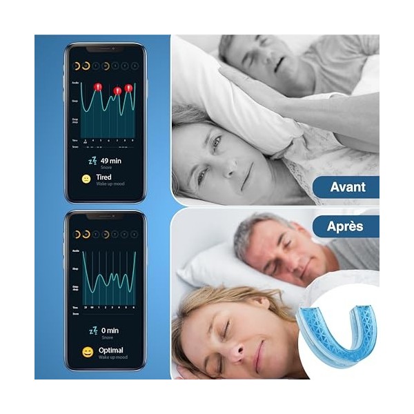 Attelle de ronflement contre le ronflement et le grincement Protège-dents anti-ronflement attelle de morsure enfin sans ron