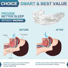 Gouttière Anti Ronflement, Réutilisable Gouttière protège-dents de nuit, anti-ronflements réglables Solutions efficaces pour 