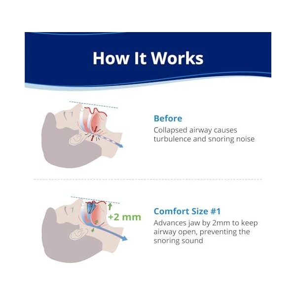 Embout buccal anti-ronflement, taille confortable 1, recharge simple, bleu, fabriqué aux États-Unis, sans BPA, matériau de q