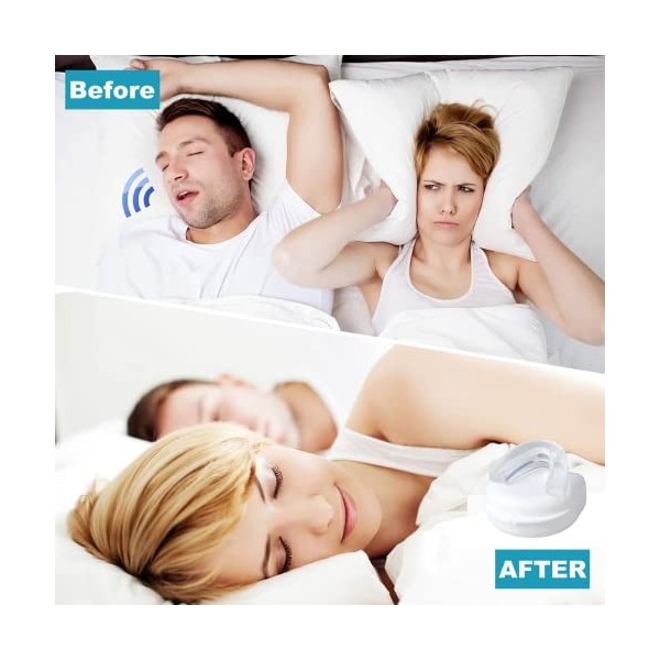 Gouttiere Dentaire Bruxisme,Bruxisme Protège Grincements De Dents,Orthese Anti Ronflement Efficace, Dispositifs Anti-Ronfleme