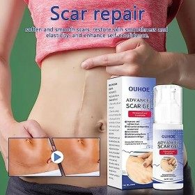 Wukesify Crème Anti-Cicatrices pour Le Visage,Gel de Cicatrice de 1,69 oz pour Le Corps - Crème denlèvement de Cicatrices ch