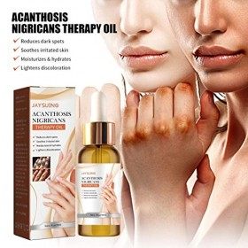 Povanjer Huile Détachante,Acanthosis Nigricans Huile de Soin pour Peaux foncées | Correcteur éclaircissant de 1,7 oz pour Les