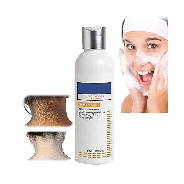 50ml Skinenjoy Cleansing Lotion for Acne & Spots & Acanthosis Nigricans, Salyzap Body Wash,Nigrifree Acanthosis Nigricans The