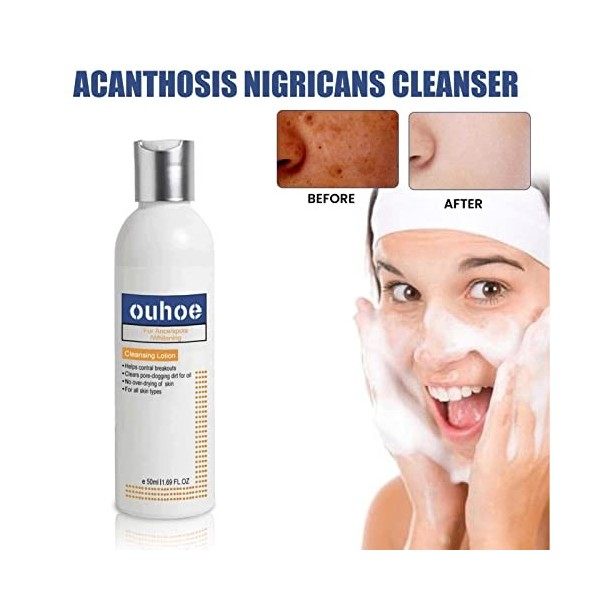 Lucchi Nettoyant blanchissant pour Les articulations Noires | Mousse nettoyante éclaircissante Coudes et Genoux foncé,Mousse 