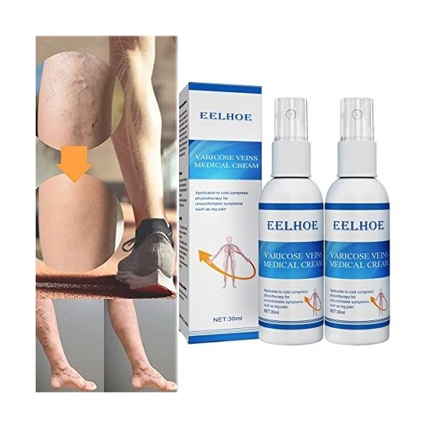 Antiedema Varicose Vein Care Treatment Spray, Anti Edema Varicose Spray, EELHOE Varicose Veins Spray, Anti Edema Vein Spray, 