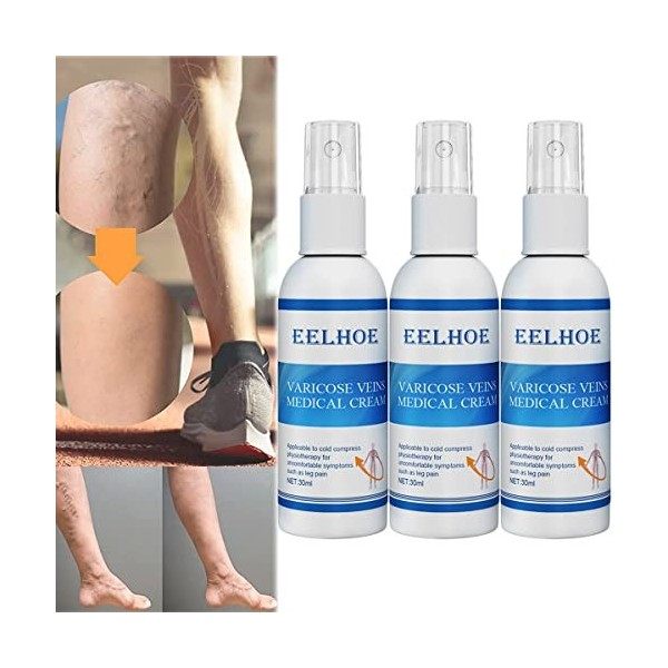 Antiedema Varicose Vein Care Treatment Spray, Anti Edema Varicose Spray, EELHOE Varicose Veins Spray, Anti Edema Vein Spray, 