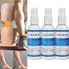 Antiedema Varicose Vein Care Treatment Spray, Anti Edema Varicose Spray, EELHOE Varicose Veins Spray, Anti Edema Vein Spray, 