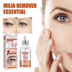 Élimine les Particules de Graisse sous les Yeux,Speedy Milia Remover,Milia Remover Under Eyes,Sérum Visage Anti-taches Foncée