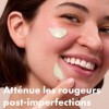 Hero Cosmetics - Rescue Balm Red Correct - Baume Correcteur Anti-Rougeurs - Atténue les rougeurs et marques laissées par lesb