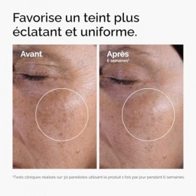 The Ordinary Tonique Exfoliant à lAcide Glycolique 7%, Tonique quotidien illuminant et lissant, pour un teint plus uniforme, ...