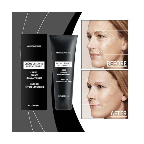 Skin Paris Creme Instant, Lima Paris Anti Ride Instantané, Creme Remplisseur De Ride, Crème Effaceur De Rides, Sérum Anti-Rid...