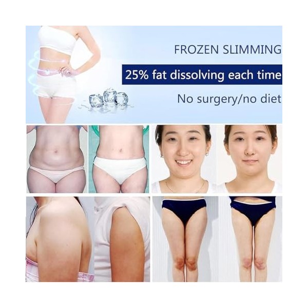 Machine de congélation des graisses pour minceur du corps – Cryolipolyse avec 3 poignées pour éliminer la cellulite pour faço