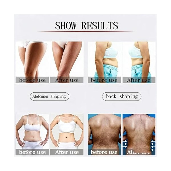 Machine à sculpter le corps avec écran LCD 7" pour éliminer la cellulite, brûler les graisses et traitement anti-rides