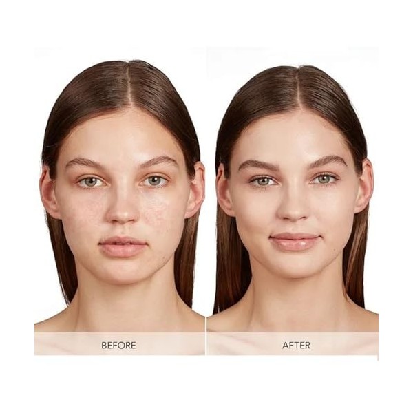 MEITREND Système de micro-infusion dacide hyaluronique, kit de micro-aiguilles, micro-infusion visage, système dinfusion de