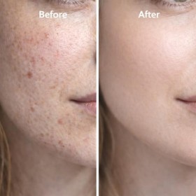 Sérum visage aux peptides de cuivre, avec acide hyaluronique - Sérum visage anti-âge pour les rides, raffermissant et hydrata