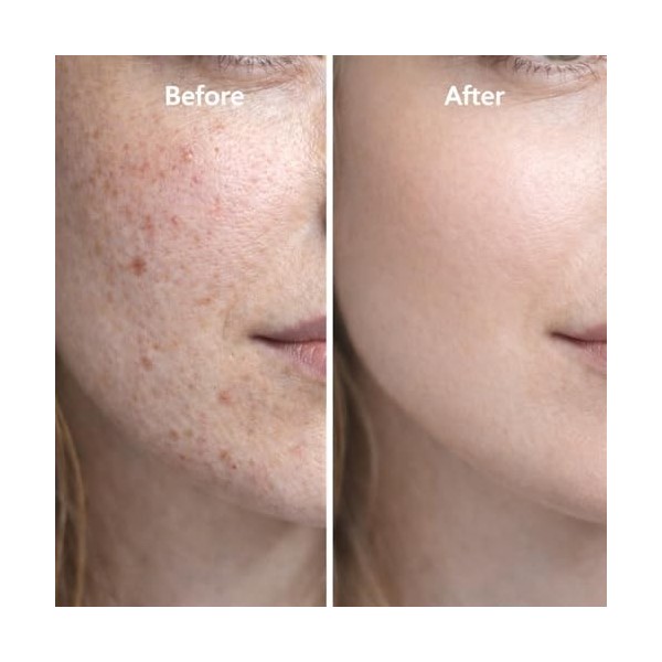 Sérum visage aux peptides de cuivre, avec acide hyaluronique - Sérum visage anti-âge pour les rides, raffermissant et hydrata