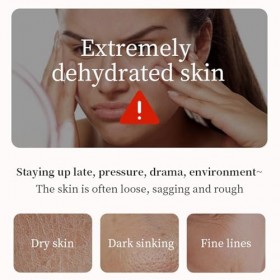 Lot de 2 sérums faciaux tout-en-un 5 en 1 avec vitamine C, E, acide hyaluronique et collagène pour tous les types de peau, sé