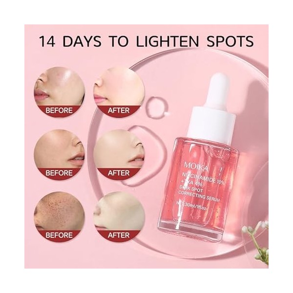 Niacinamide 10 % + 4 % TXA Sérum, sérum Dark Spot Sérum, anti-âge et anti-rides, convient à tous les types de peau Essence hy