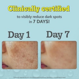 Chemist At Play Sérum visage 10 % vitamine C | Brightens & Gives Glow | Fades Dark Spots | Traitez lhyperpigmentation | Prod