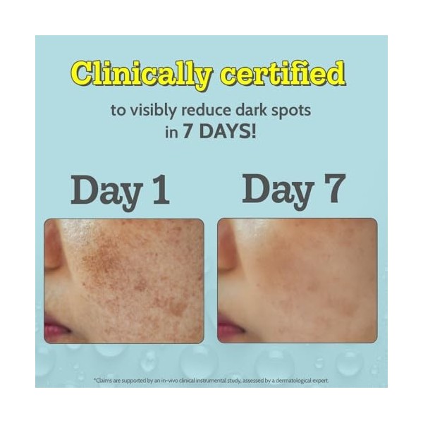 Chemist At Play Sérum visage 10 % vitamine C | Brightens & Gives Glow | Fades Dark Spots | Traitez lhyperpigmentation | Prod