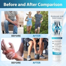 Arthroheal Hyaluronic Acid Joint Repair Cream, Hyaluronic Joint Cream, Arthroheal Crème Réparatrice pour Articulations à Lac