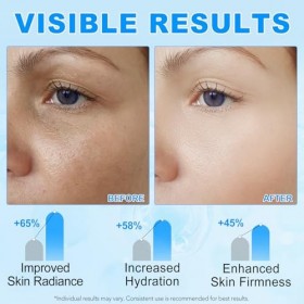 Hyaluronic Acid Powder, 120g Acide Hyaluronique Poudre,Ingrédients hydratants solubles dans leau, acide hyaluronique - soins